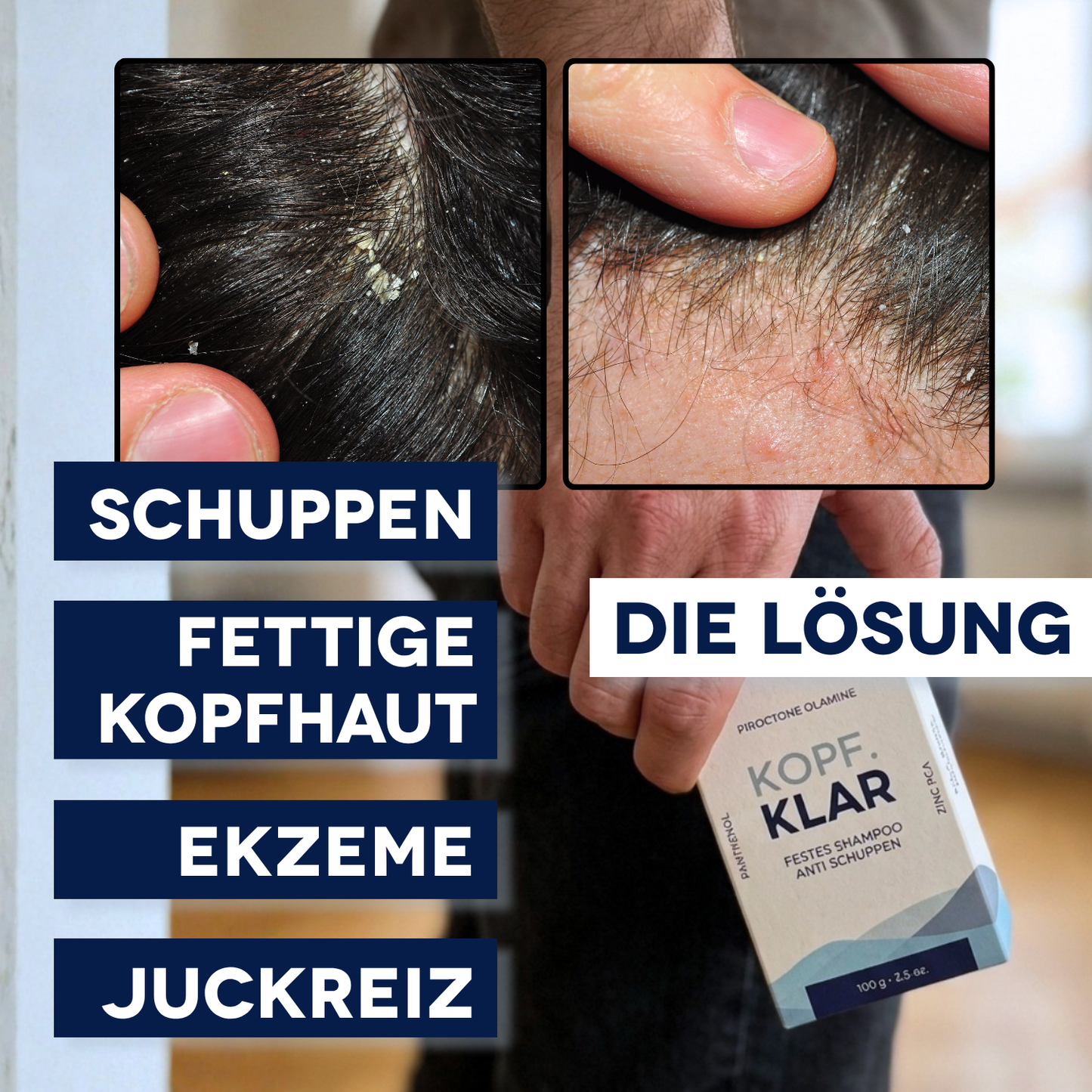 Anti Schuppen Angebot