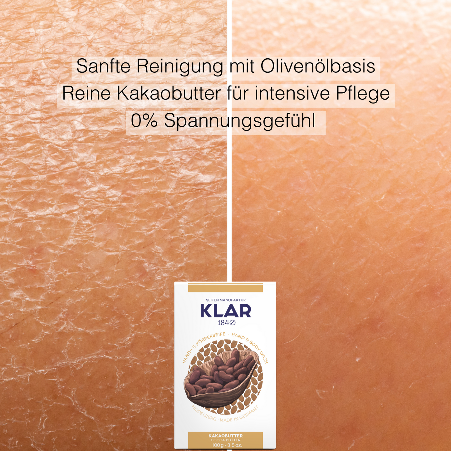 SOS Hilfe für Trockene Haut