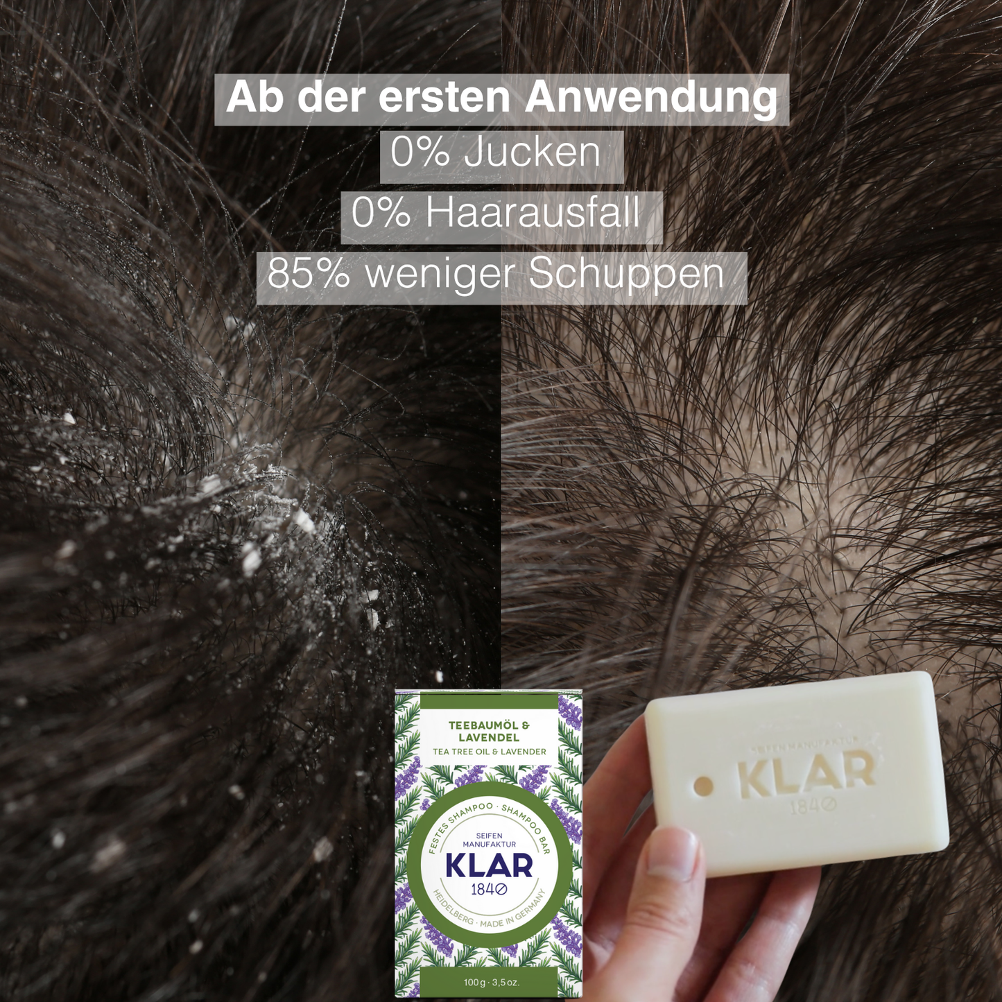 SOS Hilfe für Trockene Haut