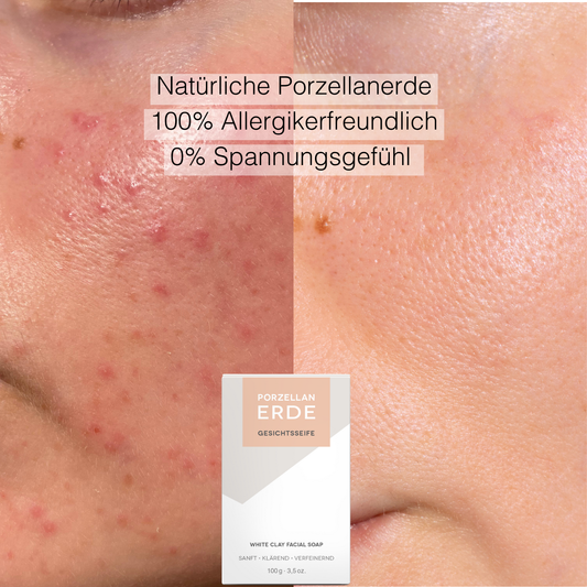 SOS Hilfe für Trockene Haut